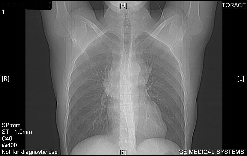 Examenul radiologic al inimii si vaselor mari